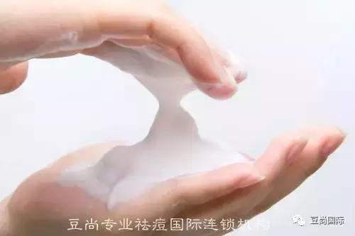 南方祛痘和北方祛痘的方法