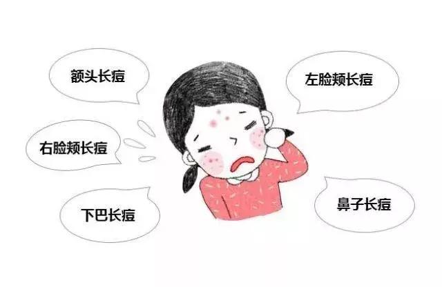 影响祛痘效果的因素都有什么